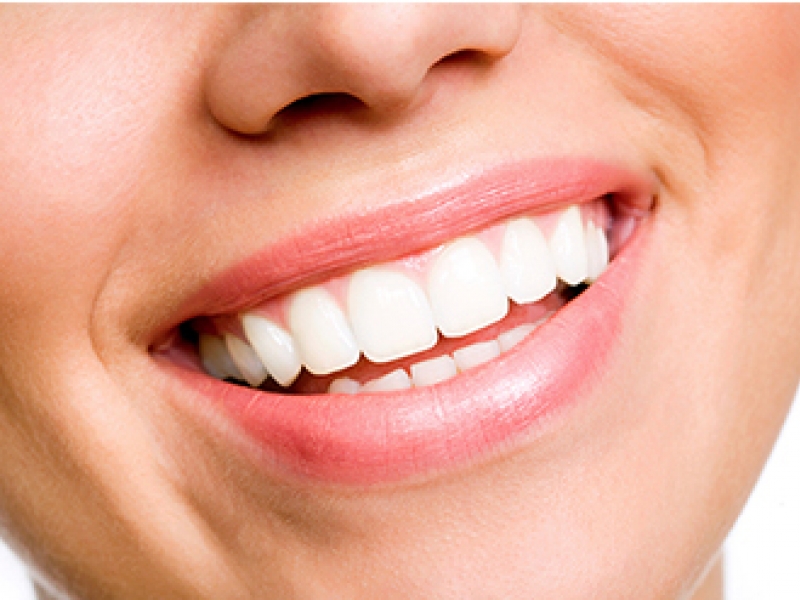 Estética dental